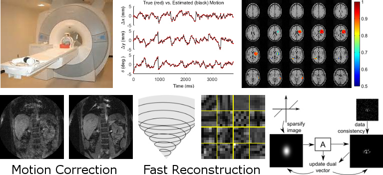 Overview with motion-corrupted MRI, MRI scanner, brain activation maps, and reconstruction models