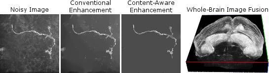 Noisy and enhanced neuron images compared, and whole-brain image fusion example