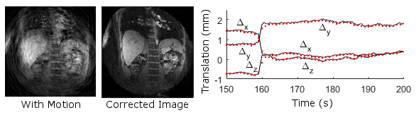 Motion-corrupted body MRI and motion estimation results